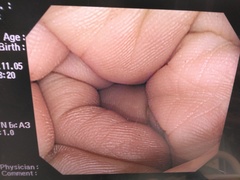 Video Gastroscope｜GIF-Q240Z｜Olympus Medical Systems photo6