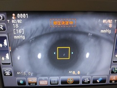 ノンコンタクトトノメータ｜CT-1 FREXY｜トプコンの写真6枚目