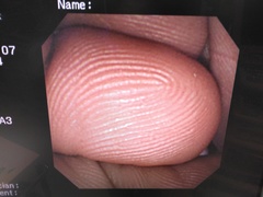 Video Duodenoscope｜JF-260V｜Olympus Medical Systems photo6