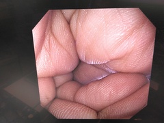 上部消化管汎用ビデオスコープ｜GIF-XP290N｜オリンパスメディカルシステムズ株式会社の写真6枚目
