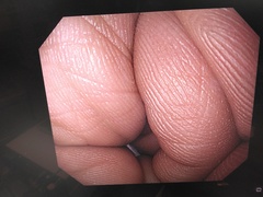 上部消化管汎用ビデオスコープ｜GIF-PQ260｜オリンパスメディカルシステムズ株式会社の写真6枚目