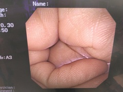 上部消化管汎用ビデオスコープ｜GIF-XP260NS｜オリンパスメディカルシステムズ株式会社の写真6枚目