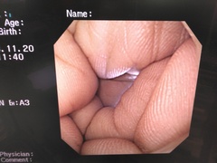 Video Gastroscope｜GIF-XQ260｜Olympus Medical Systems photo6