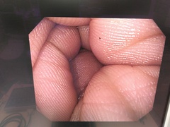 上部消化管汎用ビデオスコープ｜GIF-H290Z｜オリンパスメディカルシステムズ株式会社の写真6枚目