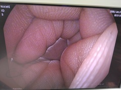 上部消化管用スコープ｜EG-1690K｜ペンタックスの写真6枚目