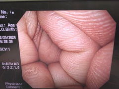 上部消化管汎用ビデオスコープ｜GIF-H260｜オリンパスメディカルシステムズ株式会社の写真6枚目