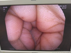 上部消化管スコープ｜EG27-i10｜ペンタックスの写真6枚目