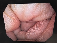 上部消化管汎用ビデオスコープ｜GIF-H170｜オリンパスメディカルシステムズ株式会社の写真6枚目