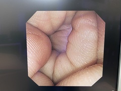上部消化管汎用ビデオスコープ｜GIF-XP260NS｜オリンパスメディカルシステムズ株式会社の写真6枚目