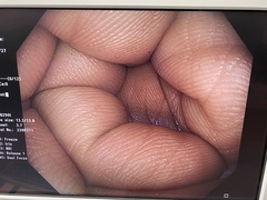 大腸ビデオスコープ｜CF-HQ290I｜オリンパスメディカルシステムズ株式会社の写真6枚目
