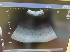 超音波診断装置（カラードプラ）｜SSA-580A Nemio XG｜キヤノンメディカルシステムズの写真6枚目