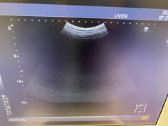 超音波診断装置（カラードプラ）｜SSA-580A Nemio XG｜キヤノンメディカルシステムズの写真6枚目