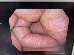 上部消化管汎用ビデオスコープ｜GIF-H170｜オリンパスメディカルシステムズ株式会社の写真6枚目