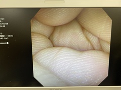 Rhinolaryngoscope｜ENF TYPE V｜Olympus Medical Systems photo6