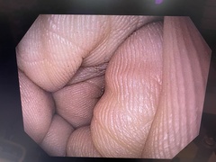 上部消化管汎用ビデオスコープ｜GIF-H190N｜オリンパスメディカルシステムズ株式会社の写真6枚目