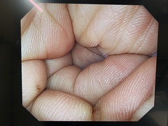 上部消化管汎用ビデオスコープ｜GIF-H290Z｜オリンパスメディカルシステムズ株式会社の写真6枚目