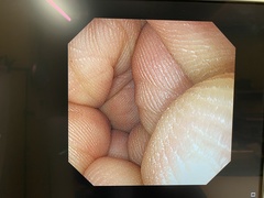 上部消化管汎用ビデオスコープ｜GIF-XP290N｜オリンパスメディカルシステムズ株式会社の写真6枚目