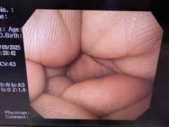 上部消化管汎用ビデオスコープ｜GIF-H260｜オリンパスメディカルシステムズ株式会社の写真6枚目