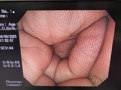 大腸ビデオスコープ｜CF-H260AI｜オリンパスメディカルシステムズ株式会社の写真6枚目
