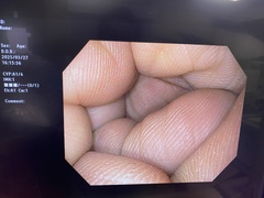 上部消化管汎用ビデオスコープ｜GIF-H170｜オリンパスメディカルシステムズ株式会社の写真6枚目