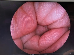 大腸ビデオスコープ｜EC-590WM3｜富士フイルムメディカルの写真6枚目