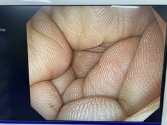 ｜GIF-1200N｜Olympus Medical Systems photo6