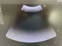 Ultrasound system｜ACUSON X700｜Mochida Siemens Medical Systems photo6