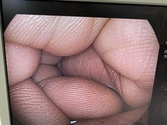 Video Gastroscope｜EG16-K10｜Pentax photo6