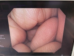 Video Gastroscope｜GIF-H260｜Olympus Medical Systems photo6