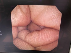 Video Gastroscope｜GIF-XP260NS｜Olympus Medical Systems photo6
