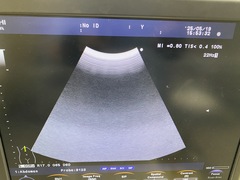 Ultrasound system｜F37｜Hitachi photo6