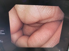 Video Gastroscope｜GIF-Q260｜Olympus Medical Systems photo6