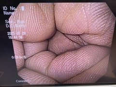 上部消化管汎用ビデオスコープ｜GIF-Q150X｜オリンパスメディカルシステムズ株式会社の写真6枚目
