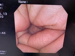 Video Gastroscope｜GIF-2T240｜Olympus Medical Systems photo6