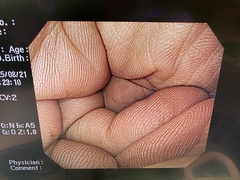 上部消化管汎用ビデオスコープ｜GIF-H260｜オリンパスメディカルシステムズ株式会社の写真6枚目
