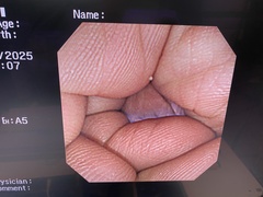 Video Colonoscope｜PCF-240I｜Olympus Medical Systems photo6