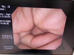 上部消化管汎用ビデオスコープ｜GIF-Q260J｜オリンパスメディカルシステムズ株式会社の写真6枚目