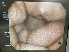Video Colonoscope｜PCF-Q260AZI｜Olympus Medical Systems photo6