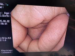 Video Gastroscope｜GIF-H260Z｜Olympus Medical Systems photo6