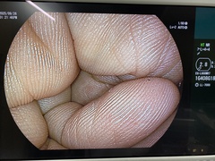 上部消化管用スコープ｜EG-L600WR7｜富士フイルムメディカルの写真6枚目