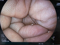 上部消化管用スコープ｜EG-L600WR7｜富士フイルムメディカルの写真6枚目