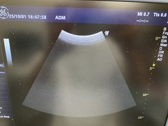 Ultrasound system(Color)｜LOGIQ P6｜GE Healthcare photo6