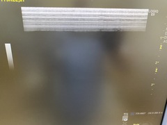 Ultrasound system｜LOGIQ E9｜GE Healthcare photo6