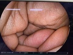 上部消化管用経鼻スコープ｜EG-530NW｜富士フイルムメディカルの写真6枚目