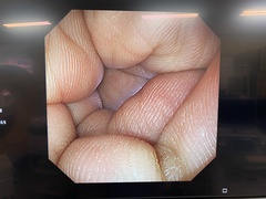 Video Gastroscope｜GIF-XP290N｜Olympus Medical Systems photo6