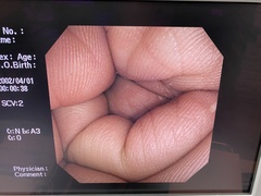 Video Colonoscope｜CF-240I｜Olympus Medical Systems photo6