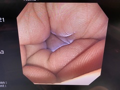 Video Gastroscope｜GIF-XP240｜Olympus Medical Systems photo6