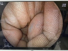 Video Transnasal Gastroscope｜EG-L580NW7｜Fujifilm Medical photo6