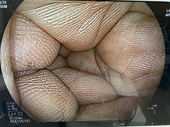 Video Transnasal Gastroscope｜EG-L580NW7｜Fujifilm Medical photo6