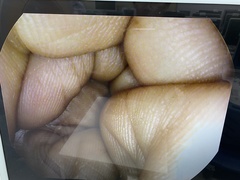 上部消化管スコープ｜EG27-i10｜ペンタックスの写真6枚目